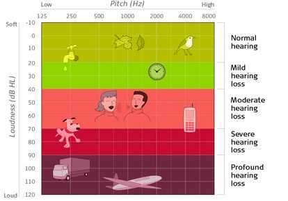 Audiogram: Picture of an Audiogram Explained